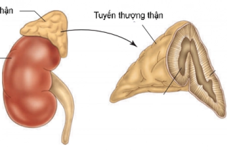 Nguyên nhân và triệu chứng của suy tuyến thượng thận cấp