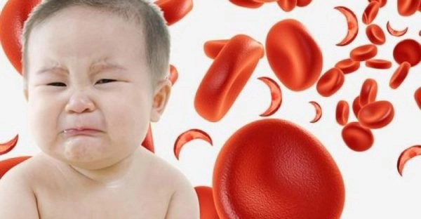 Nhận biết trẻ thiếu máu