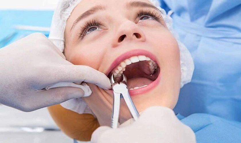Nhổ răng đã lấy tủy có đau không?