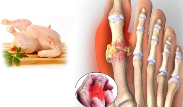Những món ăn chữa bệnh gút