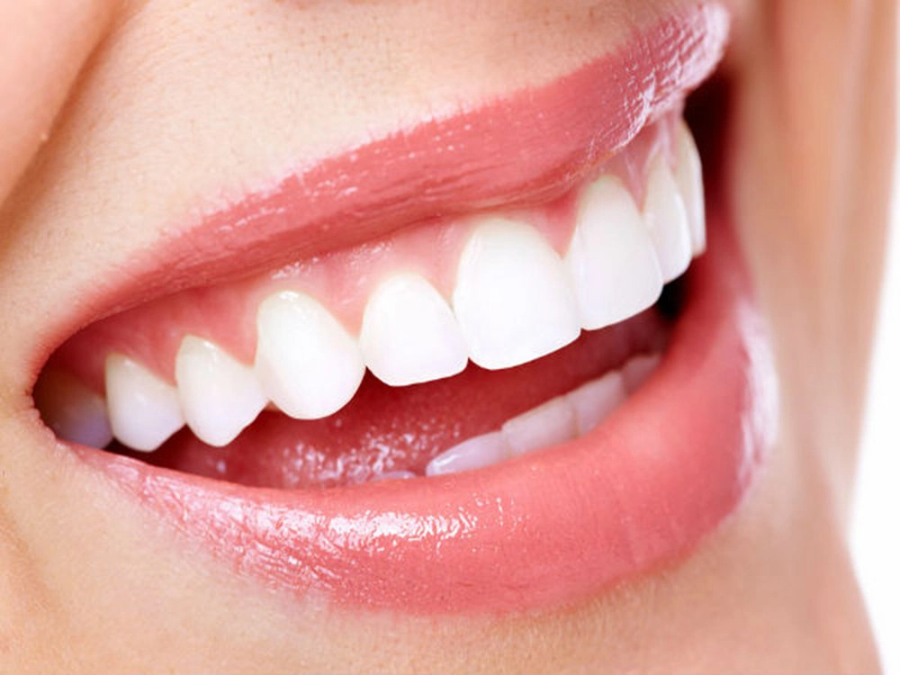 Nướu răng khỏe mạnh có màu gì?