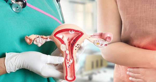 Phác đồ điều trị lạc nội mạc tử cung