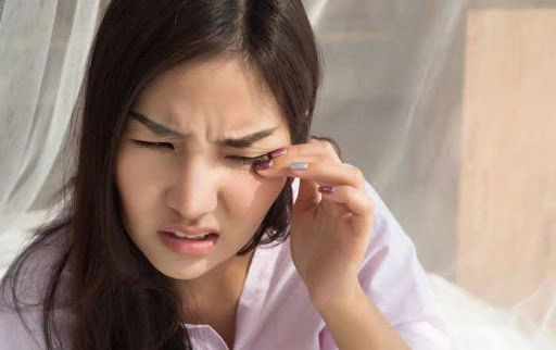 Phẫu thuật cắt mống mắt chu biên