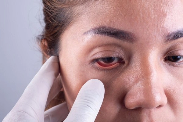 Phẫu thuật tái tạo cùng đồ