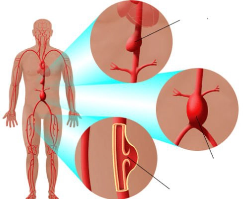 Quy trình chụp cộng hưởng từ động mạch chủ ngực