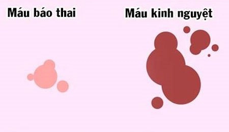 Ra máu báo thai có đau bụng không?