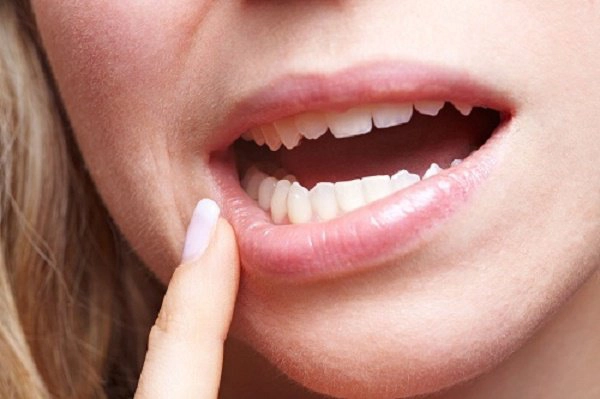 Răng hàm lung lay đau nhức có nên nhổ?