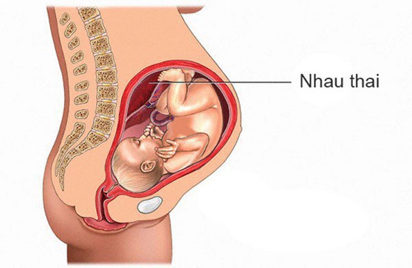 Rau bám mặt trước là sao?