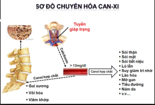 Rối loạn chuyển hóa canxi – phospho ở người bị bệnh thận mạn tính