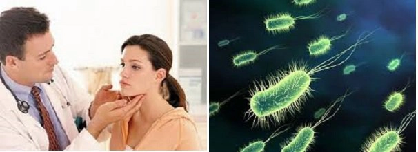 Rối loạn miễn dịch sau khi bị COVID-19 biểu hiện thế nào? Điều trị ra sao?