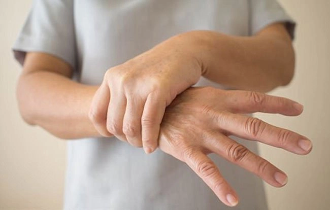 Run tay kèm ra mồ hôi tay chân là bệnh gì?