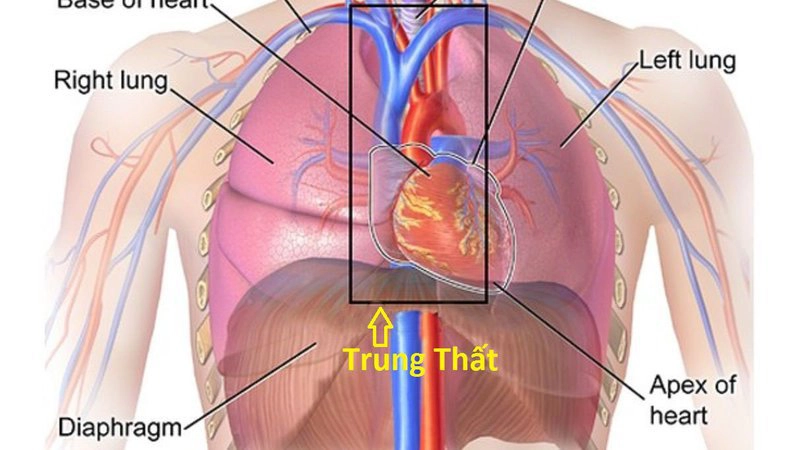 Sốt kèm hạch lao trung thất điều trị thế nào?