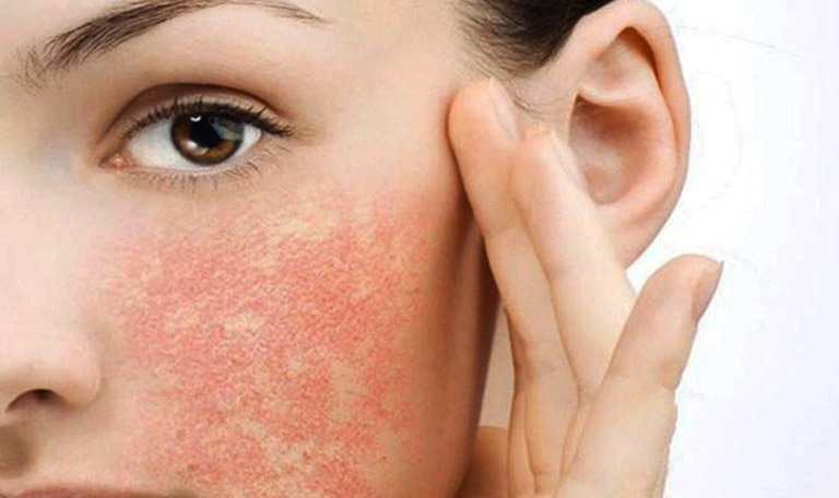 Tại sao da mặt bị ngứa thường xuyên?