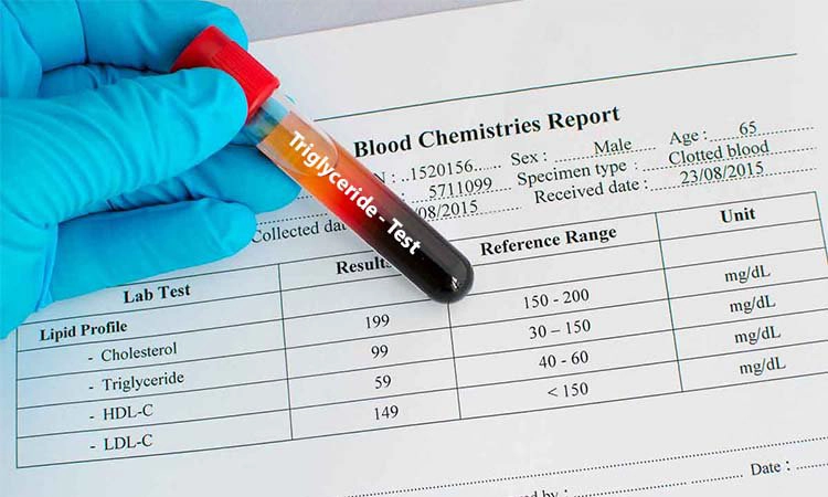 Tăng Triglycerid máu có tính chất gia đình