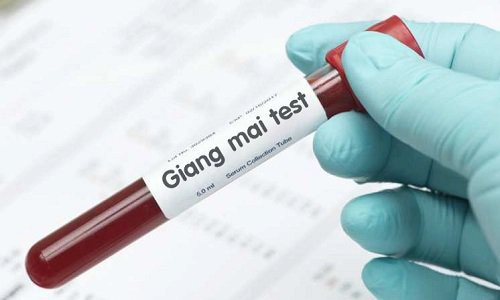 Test nhanh giang mai có chính xác?