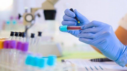 Thông tin cần biết về xét nghiệm hồng cầu lưới