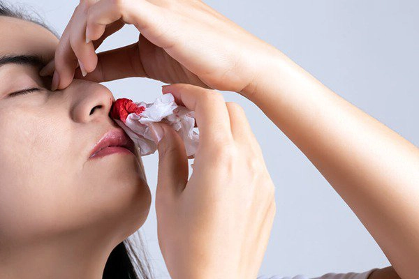 Thường xuyên chảy máu cam là biểu hiện bệnh gì?