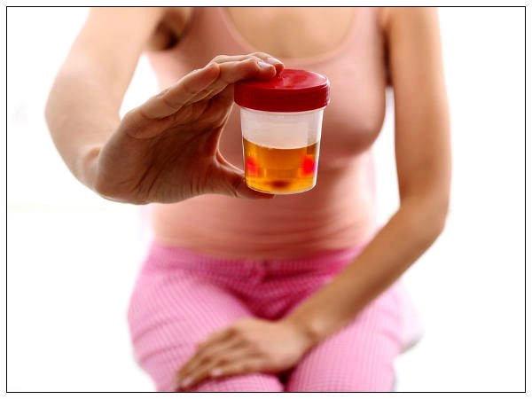 Tiểu ra máu kèm buốt khi tiểu điều trị thế nào?