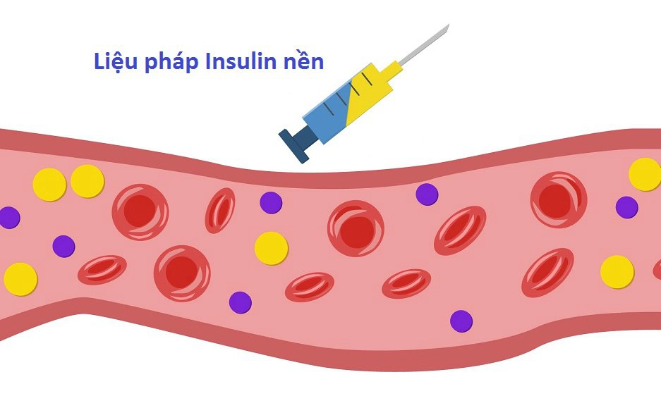 Tìm hiểu liệu pháp insulin nền