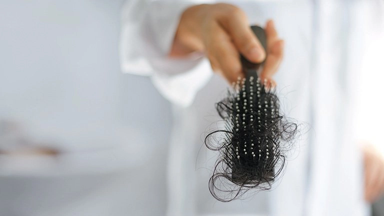 Tóc gãy rụng nhiều gây hói điều trị thế nào?