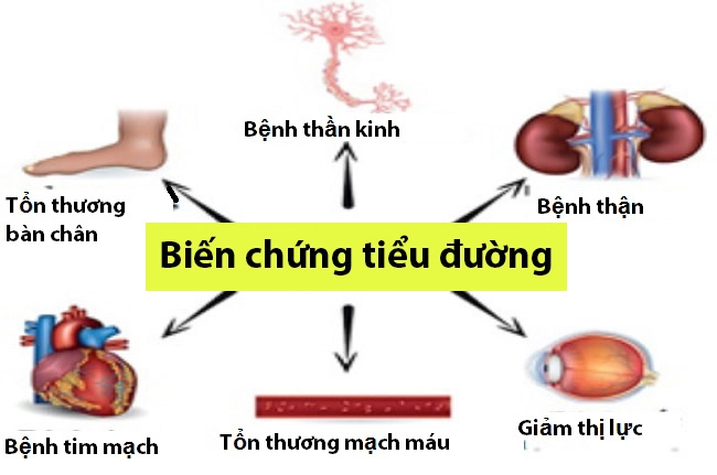 Tránh biến chứng tiểu đường: Nên ăn uống như thế nào?