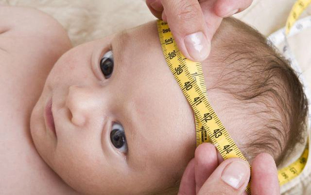 Trẻ bị não úng thủy có chữa được không?
