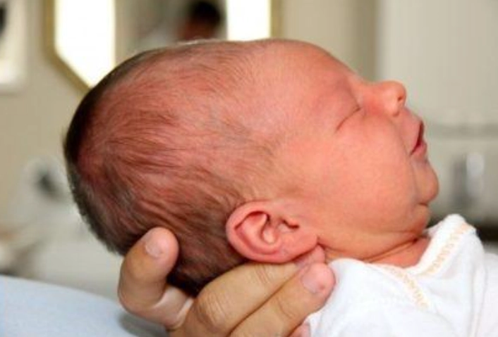 Trẻ sơ sinh đầu dài và bẹp