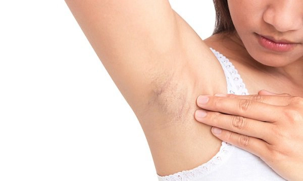 Tuyệt chiêu hết thâm nách từ nguyên liệu nhà bếp