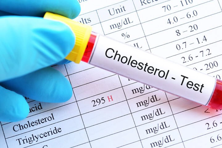 Tỷ lệ cholesterol là gì và tại sao nó lại quan trọng?