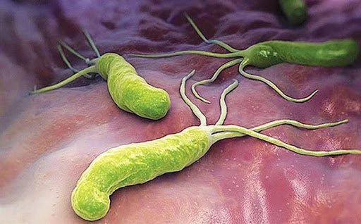 Vai trò bảo vệ của vi khuẩn H.Pylori