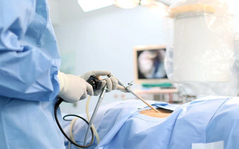 Vết mổ nội soi sỏi thận sau 1 tháng còn đau có sao không?