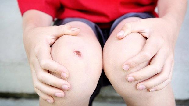 Vết thương lâu lành phải làm sao? Nên bổ sung chất gì?
