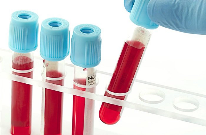 Xét nghiệm Ceruloplasmin: Ý nghĩa, chỉ định, cách thức thực hiện