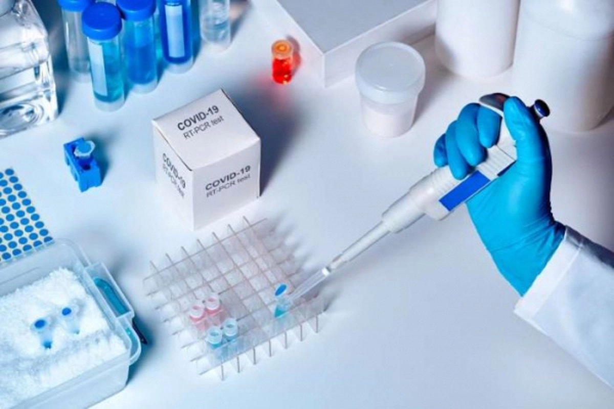 Xét nghiệm PCR kết quả dương tính/ Positive CT18 nghĩa là gì?
