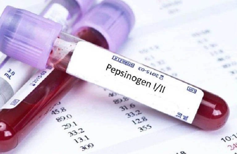 Ý nghĩa các chỉ số xét nghiệm Pepsinogen là gì?