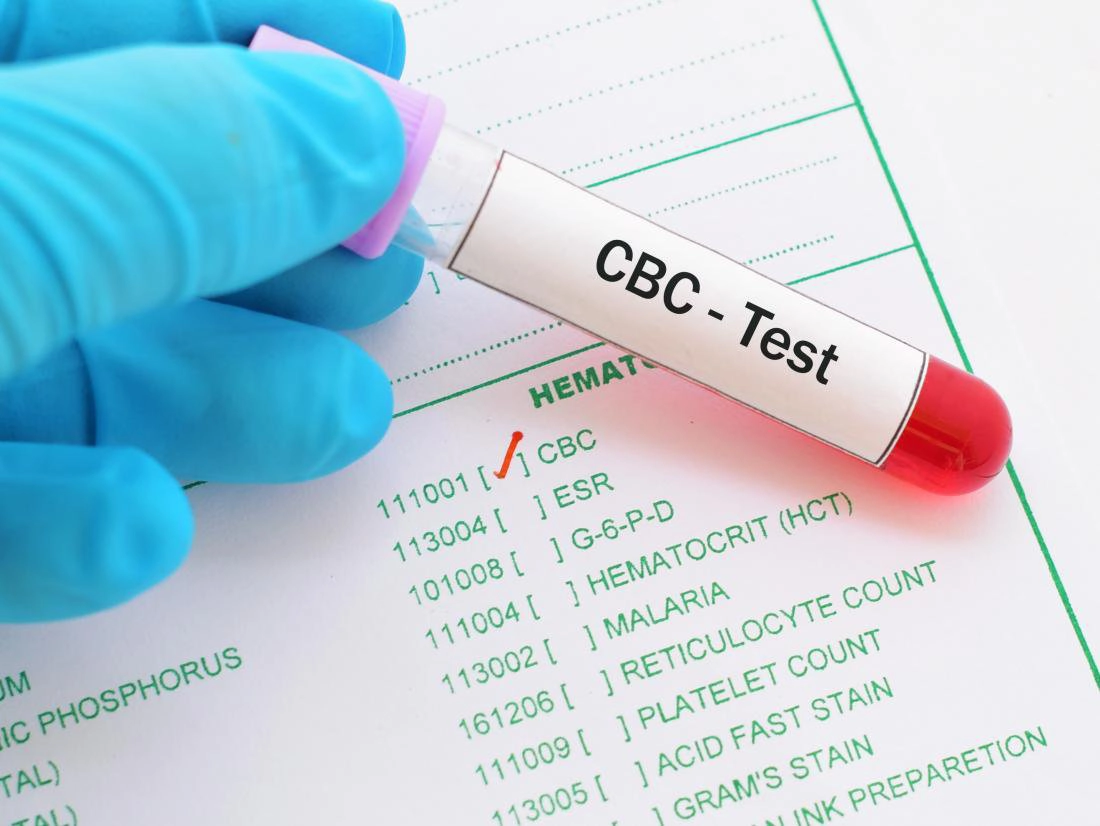 Ý nghĩa lâm sàng xét nghiệm máu toàn bộ (CBC)
