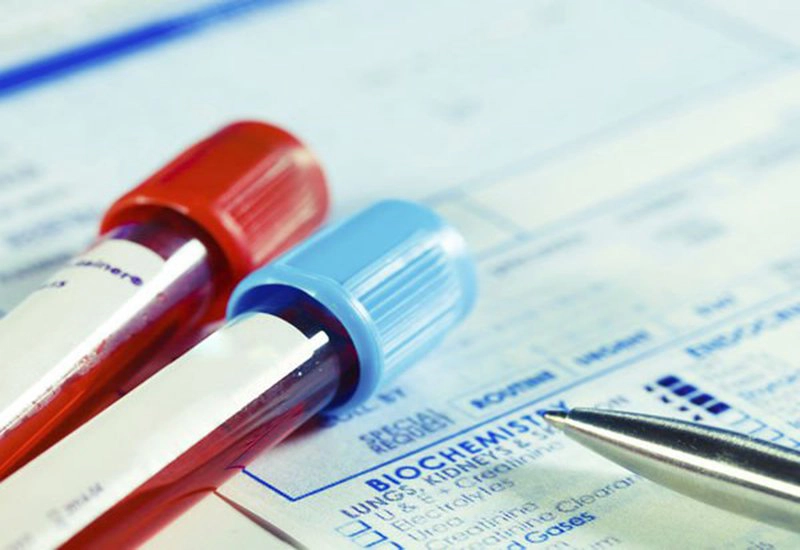 Ý nghĩa xét nghiệm SCC chẩn đoán ung thư biểu mô tế bào vảy